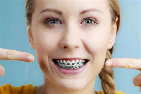 ortodonti ücretini devlet karşılıyor mu